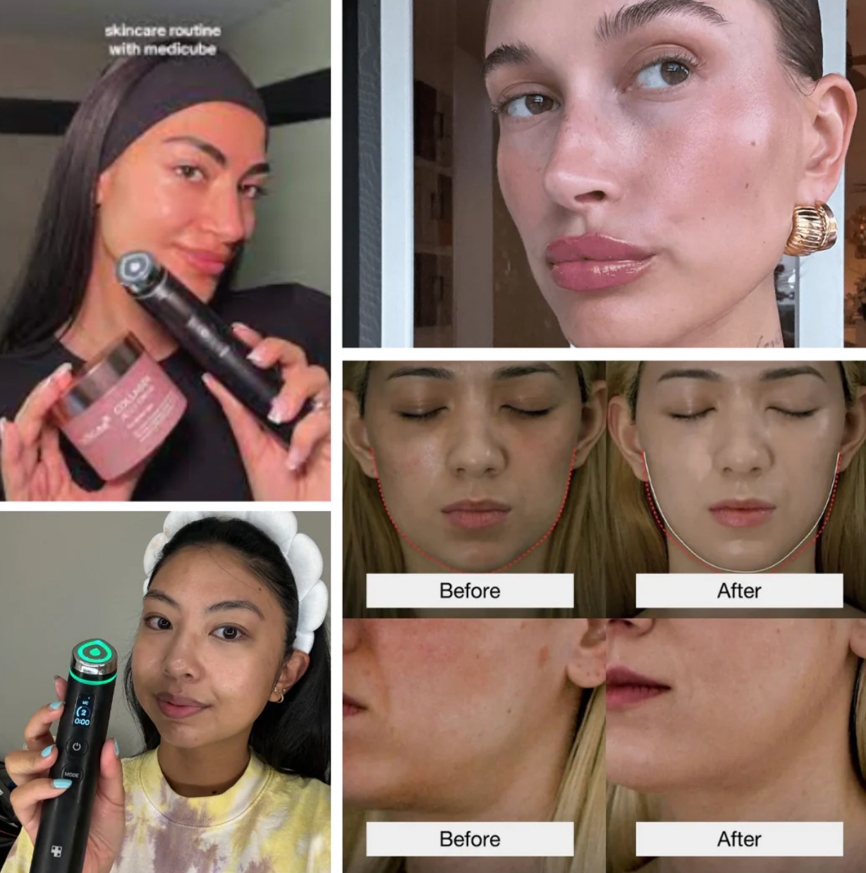 Medicube Booster Pro 6in1 Rejuvenation Device